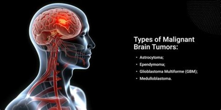 Are all malignant brain tumors fatal