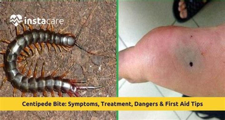 Are centipede bites dangerous to cats?