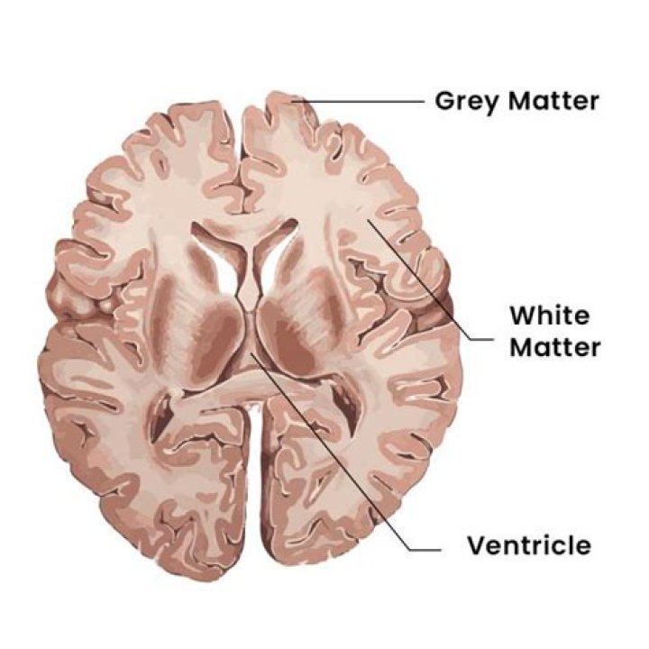 Are cerebral Peduncles white matter?