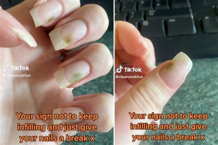 Are Glue on nails bad for you