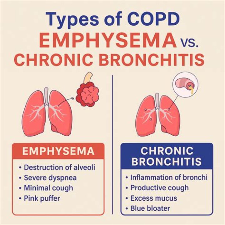 Can a person have emphysema and chronic bronchitis