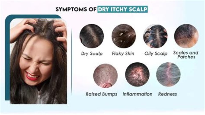Can coloring your hair cause itchy scalp?
