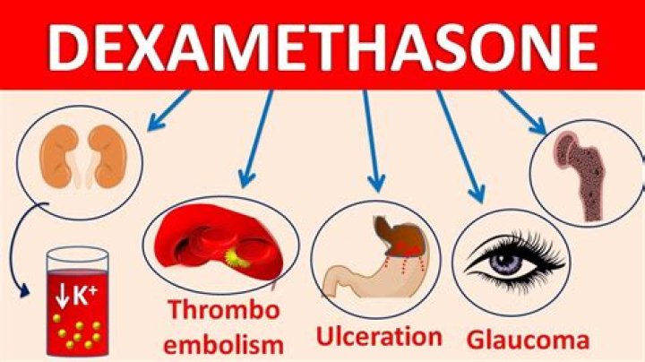 Can dexamethasone make me fat?