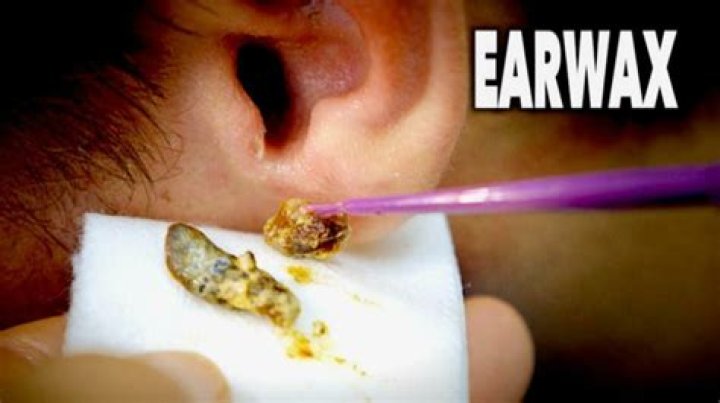 Can earwax fall out of your ear?