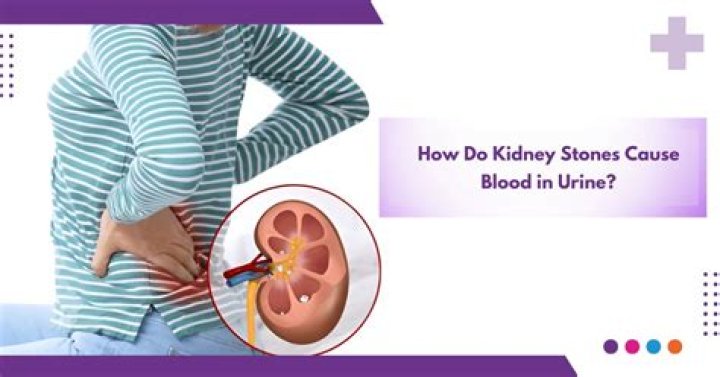 Can kidney problems cause strep throat