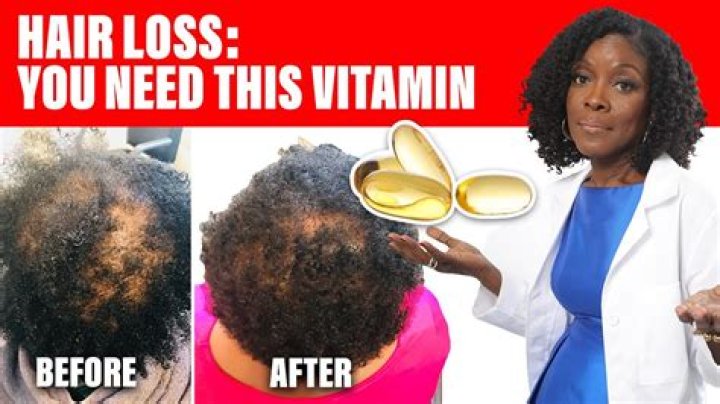 Can lost hair be regrown?