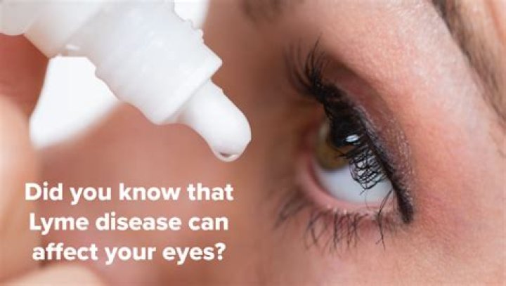 Can Lyme disease affect your eyesight?