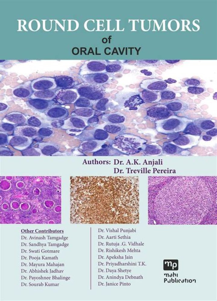 Can round cell tumors be benign?