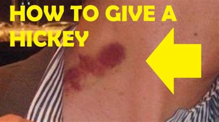 Can u give yourself a hickey with a vacuum?