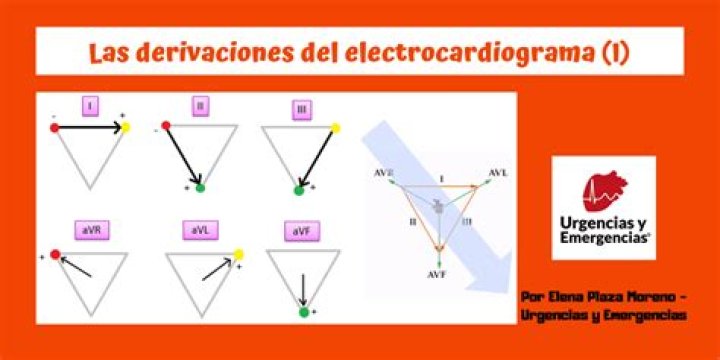 ¿Cuántas derivaciones tiene un electrocardiograma?