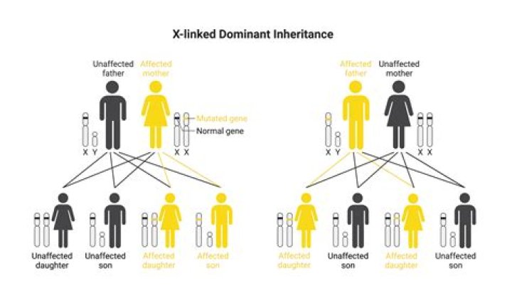 Do y linked diseases exist