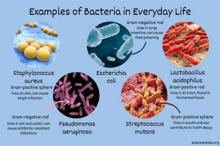 Do you capitalize bacteria names?