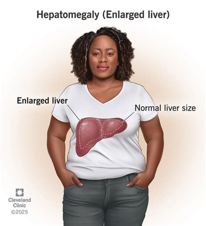 How do you assess for enlarged liver