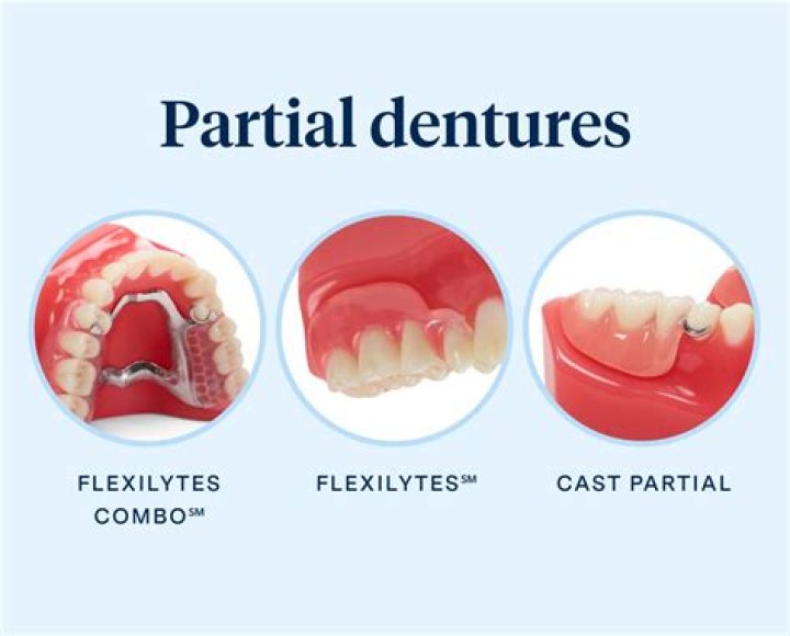 How do you get dentures to stay in place?