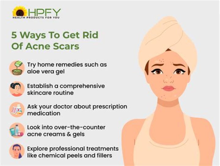 How do you get rid of hummingbird vines