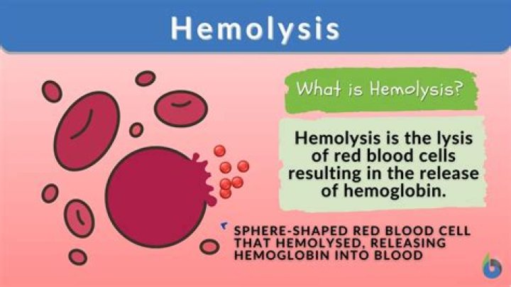How do you identify beta hemolysis?