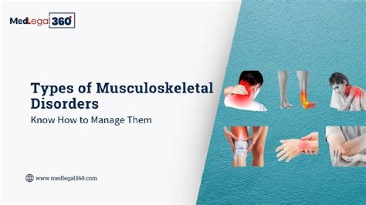 How do you manage musculoskeletal injuries