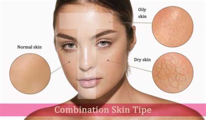 How do you stop oily skin?