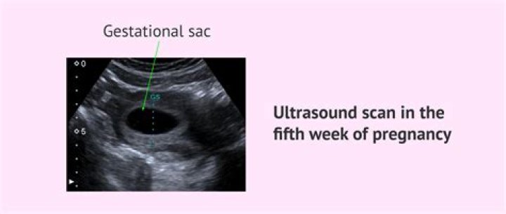 How is a groin ultrasound done
