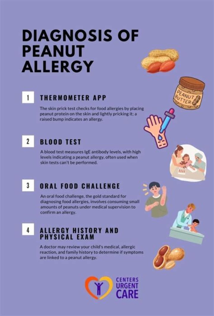How long after eating peanuts will an allergic reaction occur?