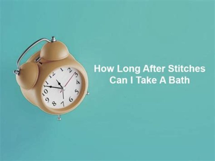 How long after stitches can I take a bath?