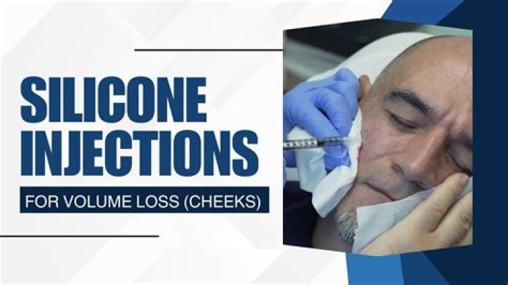 How long do silicone masks last?