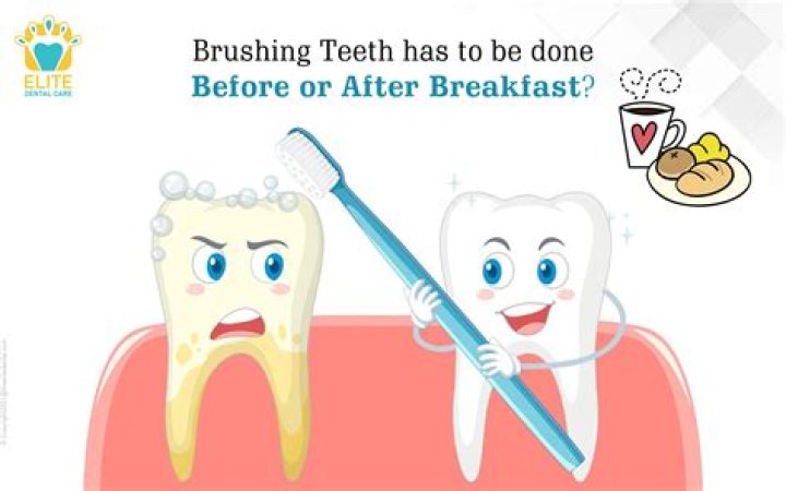 How long do you leave 35 bleach on your teeth?