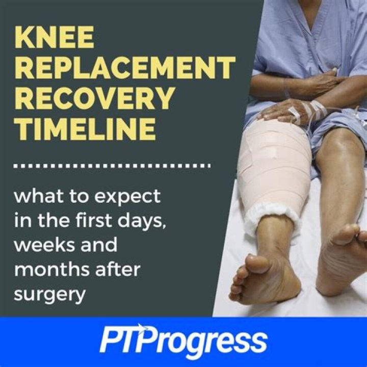 How long does it take to recover from Apr surgery