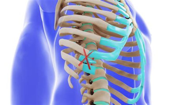 How long does rib dysfunction take to heal