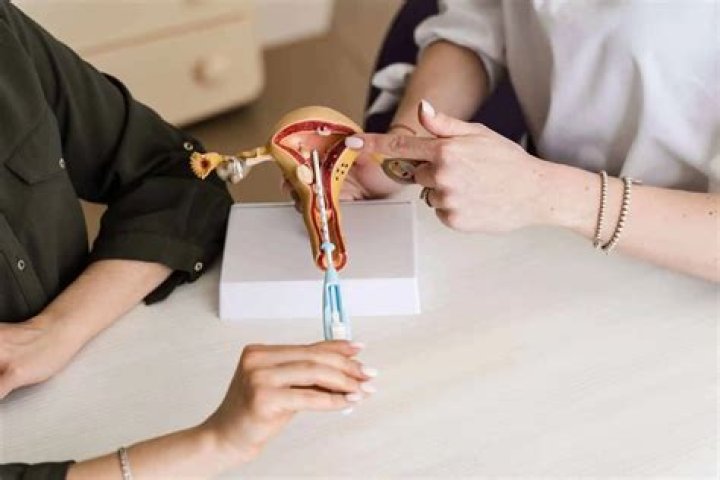 How much is IUD removal?