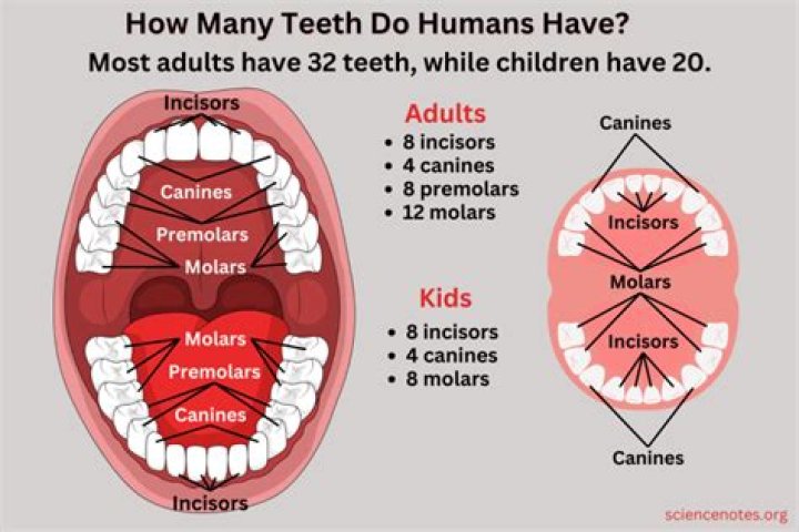 Is it normal to have 32 teeth?