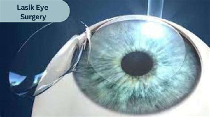 Is Lasik eye surgery covered by Tricare?