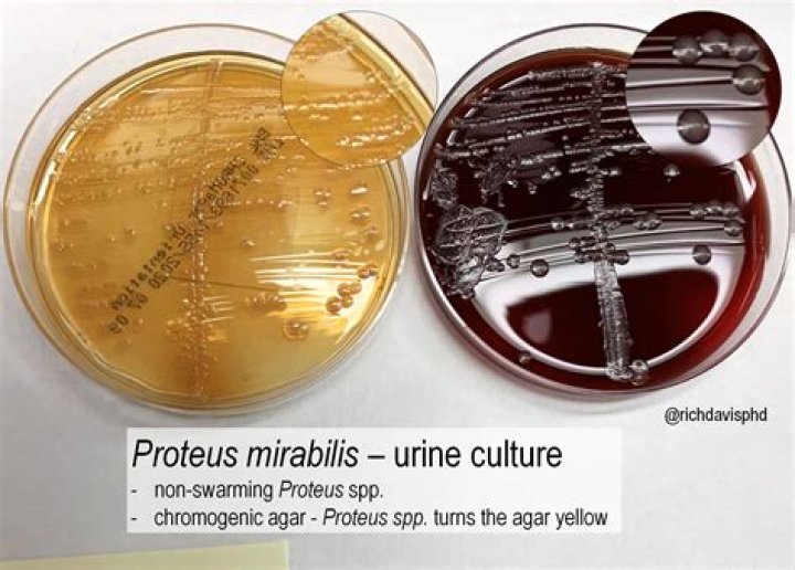 Is Proteus vulgaris a coliform