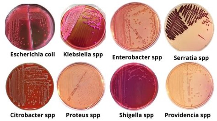 Is Shigella oxidase positive or negative