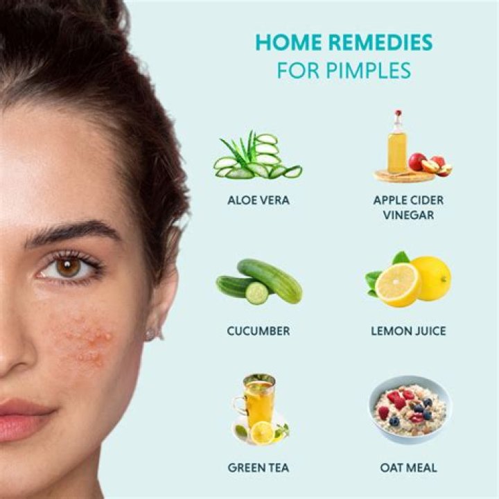 Is turmeric and lemon good for pimples?