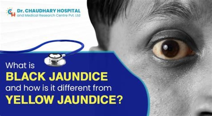 Is yellow jaundice catching?