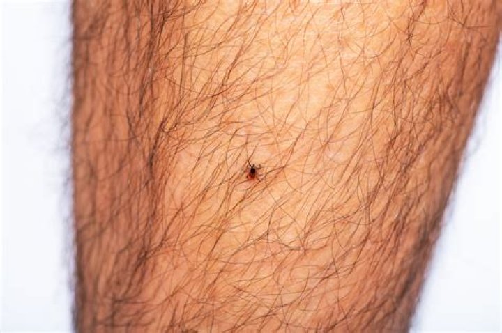 Should I be worried if I found a tick on me