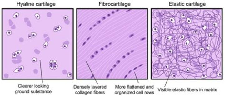 What are the characteristics of hyaline cartilage
