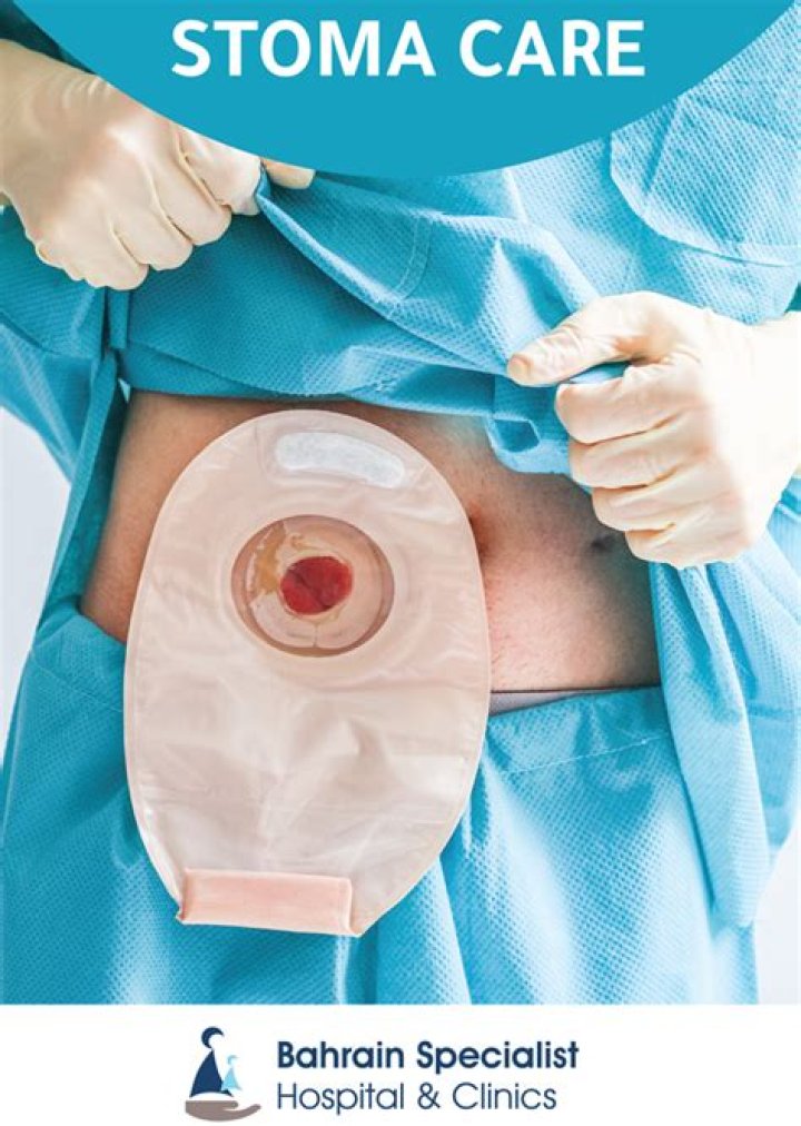 What can I use to clean a stoma