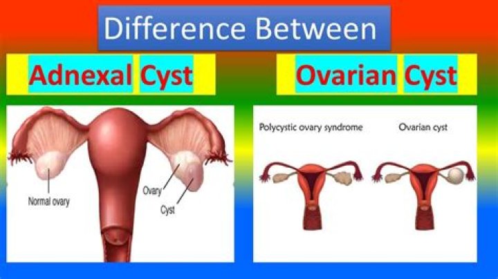 What causes adnexal cyst