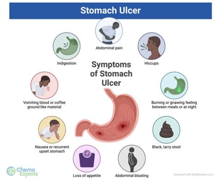 What causes gastric ulcers? | ContextResponse.com