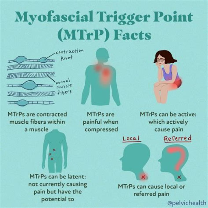 What causes myofascial trigger points