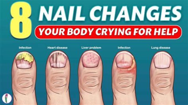 What causes nails to grow fast