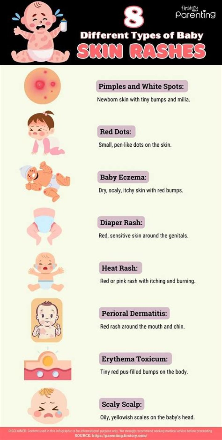 What causes rashes on babies face and neck?