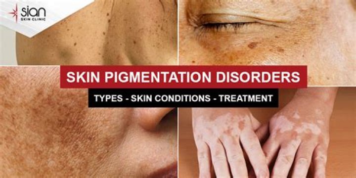 What causes skin pigmentation disorders