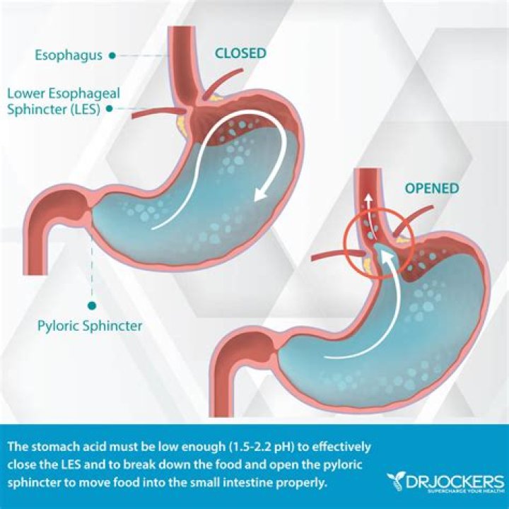 What causes the pyloric sphincter to close