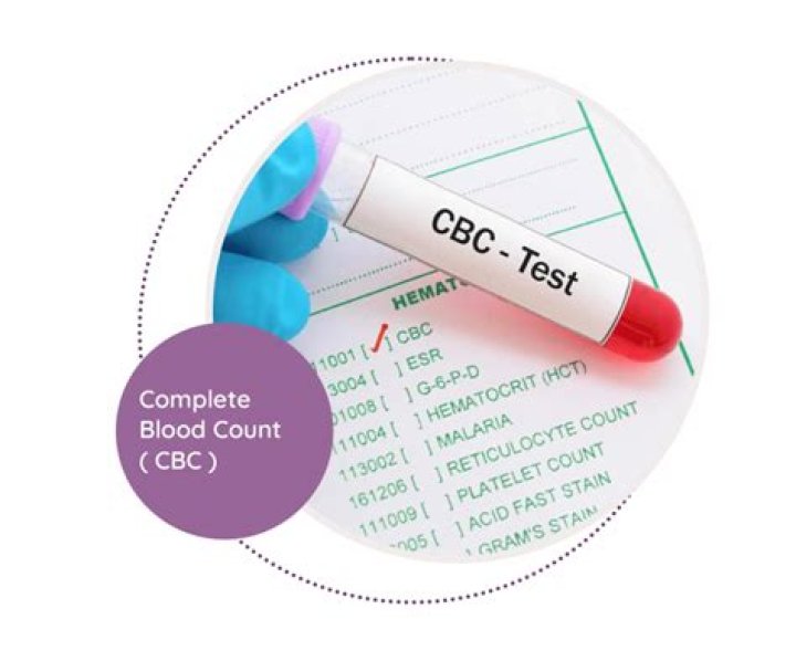 What does CBC check for?