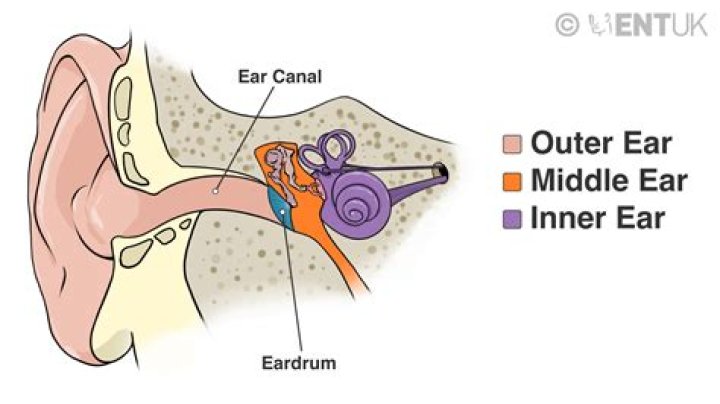 What does Myringitis mean? | ContextResponse.com