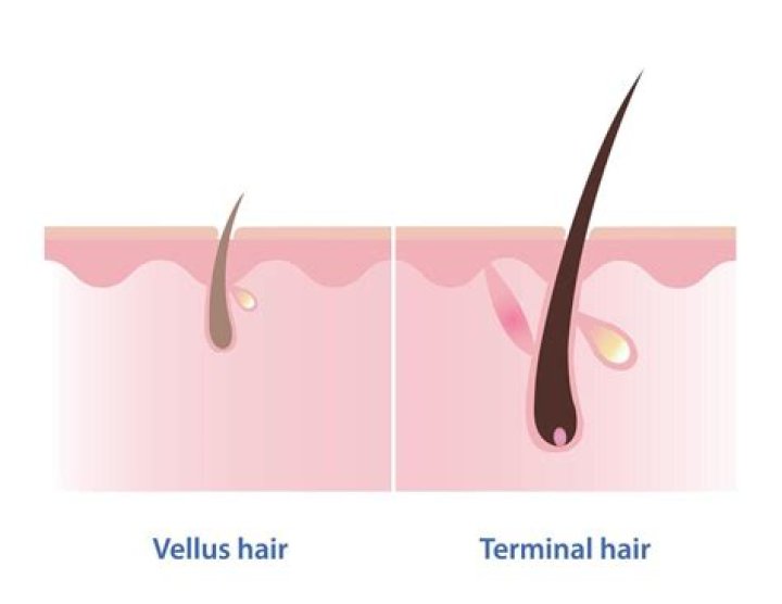 What does Terminal hair look like