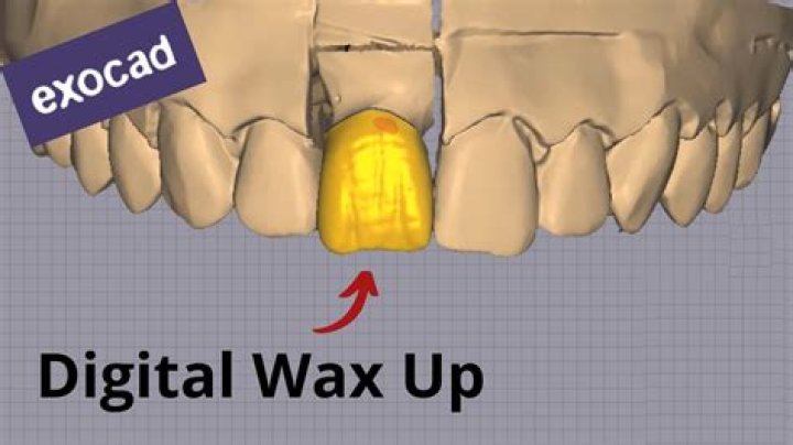 What does wax potted mean